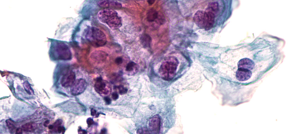 Papillomavirus au microscope
