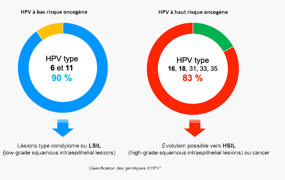 Schéma avec HPV à bas risque oncogène (6 et 11) et à haut risque oncogène (16, 18, 31, 33 et 35)